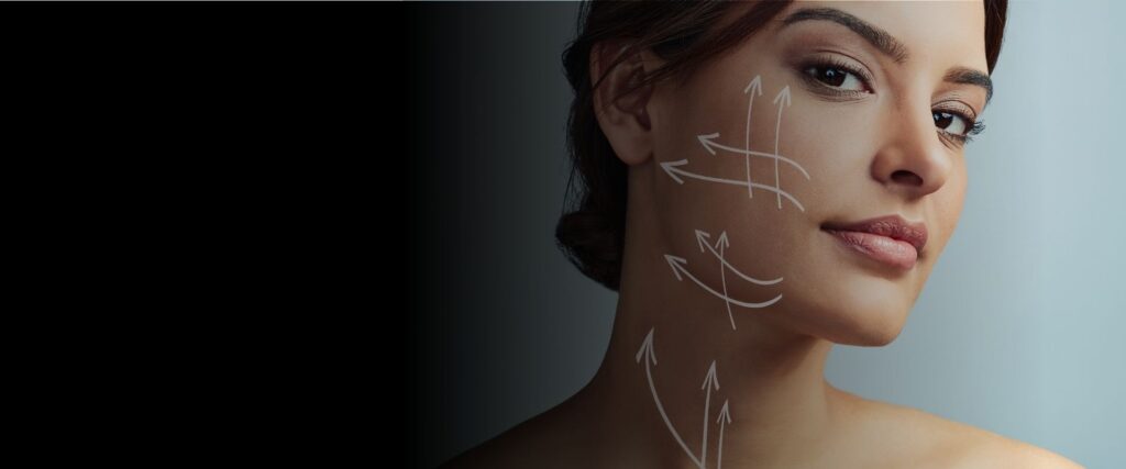 how long does a deep plane facelift last