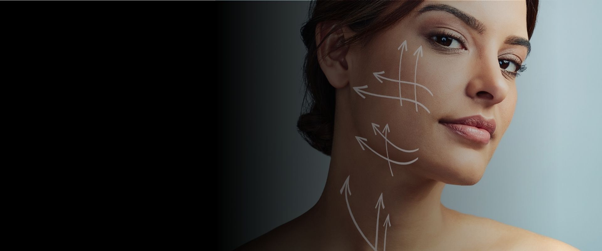 how long does a deep plane facelift last