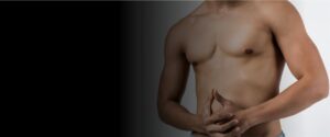 How to know if you have Gynecomastia or Chest fat